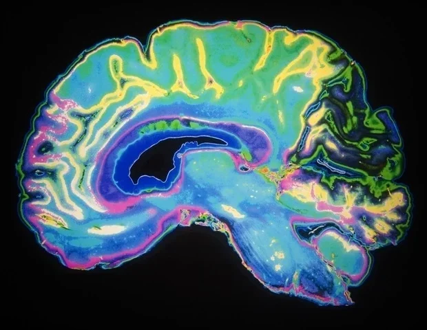 Study uncovers how brain cells coordinate movement planning