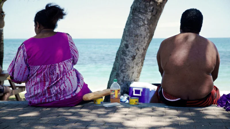 Obesity rises sharply as French Polynesia faces chronic health challenges