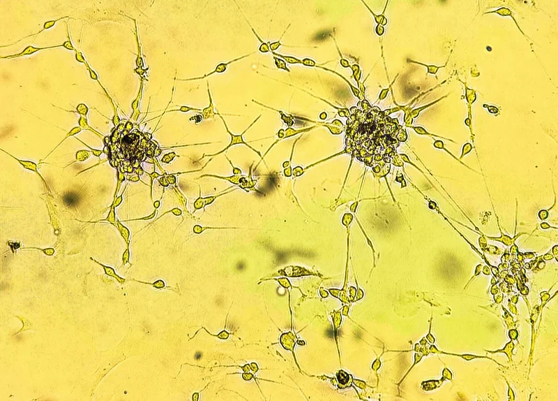 Cannabis compounds may weaken glioblastoma response to chemotherapy and radiation