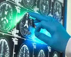 Alzheimer’s research is latest casualty in Trump administration war against ‘DEI’