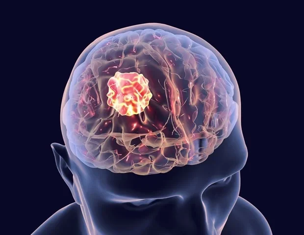 Scientists combine imaging and phototherapy in a single tool against glioblastoma
