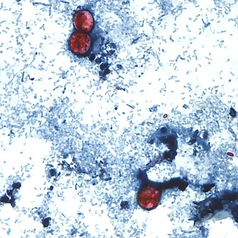 Cyclospora outbreak tied to lettuce now linked to 15 states: reports