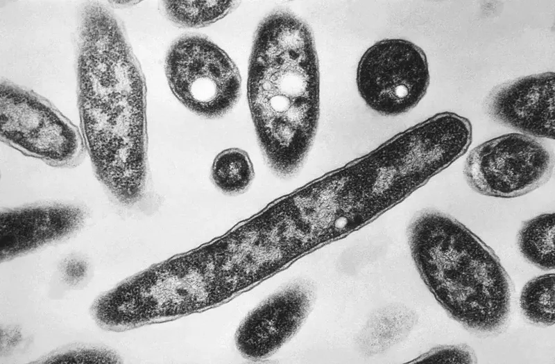 Toronto Public Health investigating legionnaires’ disease outbreak near downtown core