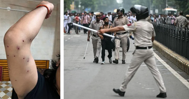 Ten persons injured by pellets during youth protest march to Parliament, shows RTI response