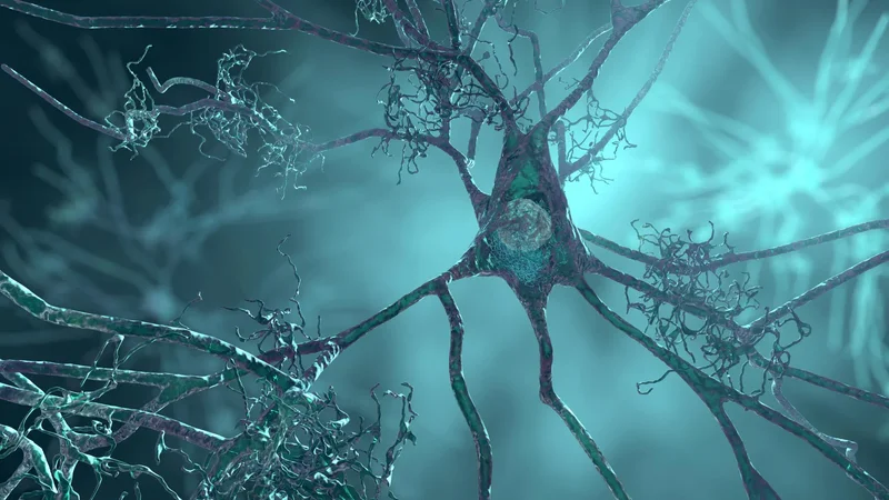 A major Alzheimer’s risk gene may shrink brain cells years before symptoms