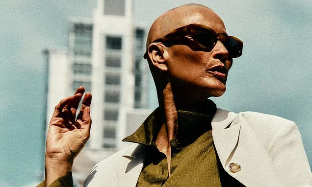 Melanie Sykes looks beautiful in first shoot since shaving her head after revealing alopecia battle