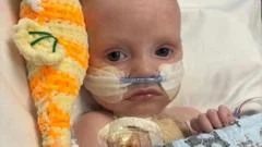 Baby whose parents feared had just days to live is 'thriving' after life-saving heart operation