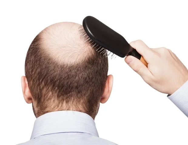 New 3D mapping technology reveals how hair follicles form over time