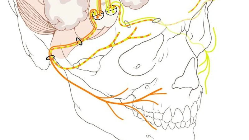When one side of your face won’t stop twitching