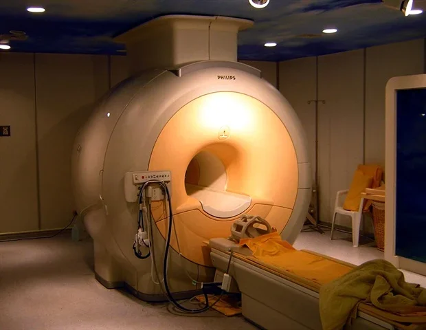 New metric detects early Alzheimer’s changes in brain white matter