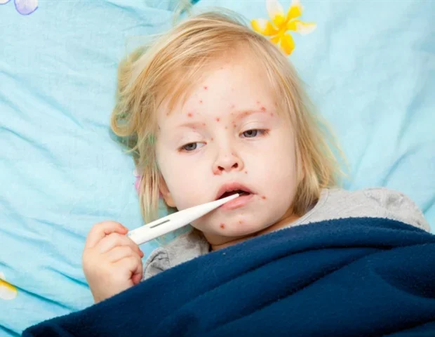 Study reveals steep financial burden of New Mexico measles outbreak