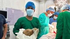 Doctors remove 3.1kg stone from man's bladder and claim record