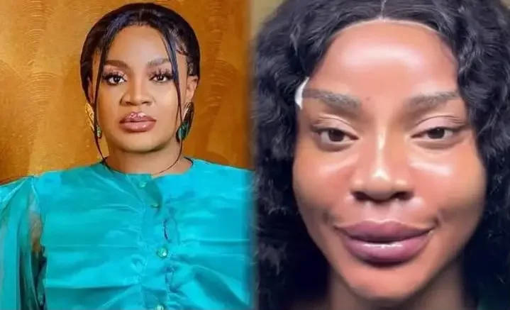 ‘I don’t like how I look’- Uche Ogbodo after facial transformation